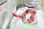 Над 250 недоносени бебета ще преминат безплатен ултразвуков скрининг в Токуда 