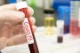 Д-р Джоузеп Джанса: България няма да се размине със заразата от коронавирус 