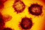  8 съмнителни проби за коронавирус от Плевен и Габрово