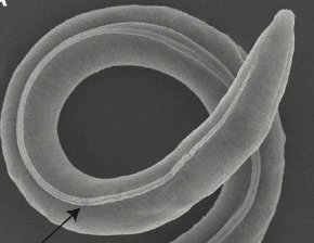 
Учени откриха женски микроскопичен кръгъл червей, който е бил заседнал дълбоко в сибирската вечна замръзналост в продължение на 46 000 години, съобщи The Washington Post. Когато го съживили, червеят започнал да ражда деца чрез процес, наречен партеногенеза, който не изисква партньор.