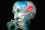 Алгоритъм диагностицира Алцхаймер десетилетие преди симптомите