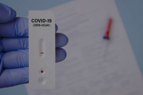 ДО момента пациентите могат да получават направление за PCR изследване за наличието на коронавирусна инфекция само след консултация от лекар специалист, а не от общопрактикуващ лекар. 