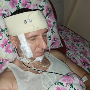 Мъж от руската област Новосибирск твърди, че едва не е починал, след като се е опитал да си направи мозъчна операция с помощта на ръчна бормашина, за да контролира сънищата си.