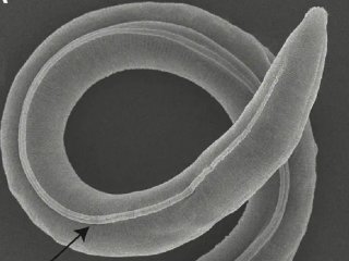 Учени откриха женски микроскопичен кръгъл червей който е бил заседнал