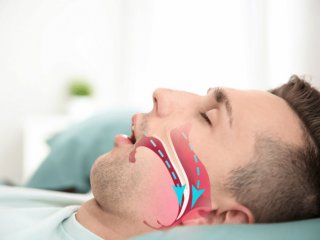 Ако хъркате звучно може би страдате от обструктивна сънна апнея