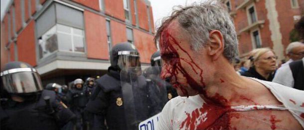 337 жертви на испанската полиция за свободата на Каталуня